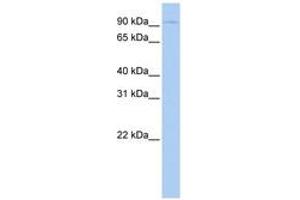 Image no. 1 for anti-Thyroid Stimulating Hormone Receptor (TSHR) (AA 180-229) antibody (ABIN6743075) (TSH receptor antibody  (AA 180-229))