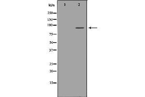 Western blot analysis of extracts of Jurkat, using FGFR1 antibody. (FGFR1 antibody  (C-Term))
