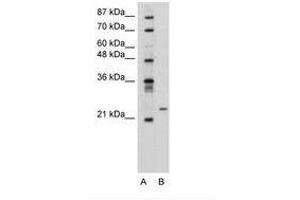 Image no. 2 for anti-Polyamine Modulated Factor 1 (PMF1) (AA 59-108) antibody (ABIN6736312)