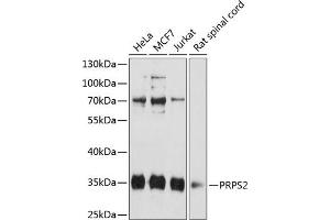 Western blot analysis of extracts of various cell lines, using PRPS2 antibody (ABIN6132522, ABIN6146273, ABIN6146275 and ABIN6216353) at 1:3000 dilution. (PRPS2 antibody  (AA 1-240))