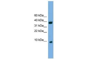 RPS21 antibody used at 1 ug/ml to detect target protein. (RPS21 antibody  (Middle Region))