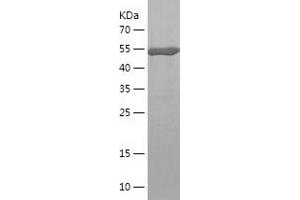 Western Blotting (WB) image for Chloride Intracellular Channel 1 (CLIC1) (AA 1-241) protein (His-IF2DI Tag) (ABIN7122351) (CLIC1 Protein (AA 1-241) (His-IF2DI Tag))
