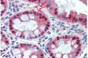 Human Colon (formalin-fixed, paraffin-embedded) stained with SCML1 antibody ABIN462201 followed by biotinylated goat anti-rabbit IgG secondary antibody ABIN481713, alkaline phosphatase-streptavidin and chromogen. (SCML1 antibody  (AA 108-157))