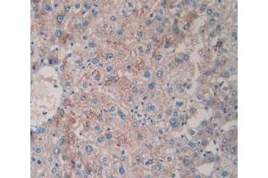 DAB staining on IHC-P; Samples: Human Liver Tissue (TPSAB1 antibody  (AA 161-262))