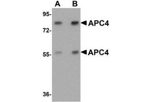 Western blot analysis of APC4 in mouse liver tissue lysate with APC4 antibody at (A) 1 and (B) 2 μg/ml. (ANAPC4 antibody  (N-Term))