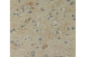 Figure. (UPRT antibody  (AA 75-297))
