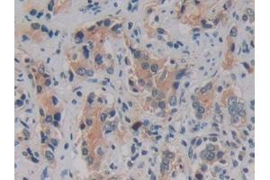 Immunohistochemistry (IHC) image for anti-Kallikrein 2 (KLK2) (AA 19-261) antibody (ABIN7435352)