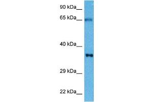 Host:  Mouse  Target Name:  TNNT2  Sample Tissue:  Mouse Skeletal Muscle  Antibody Dilution:  1ug/ml (Cardiac Troponin T2 antibody  (N-Term))