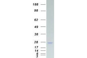 SSX2 Protein (Transcript Variant 1) (Myc-DYKDDDDK Tag)