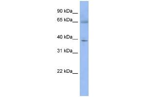 WB Suggested Anti-ZNF302 Antibody Titration:  0. (ZNF302 antibody  (N-Term))