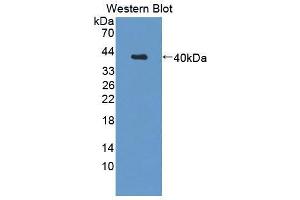 Western blot analysis of the recombinant protein. (Calpain 5 antibody  (AA 26-343))