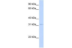 WB Suggested Anti-NKX3-1 Antibody Titration:  0. (NKX3-1 antibody  (Middle Region))