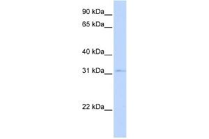 WB Suggested Anti-NKX3-1 Antibody Titration:  0.