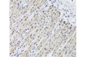 Immunohistochemistry of paraffin-embedded Mouse stomach using FANCL Polyclonal Antibody at dilution of 1:100 (40x lens). (FANCL antibody)
