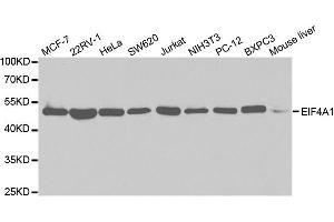 Western Blotting (WB) image for anti-Eukaryotic Translation Initiation Factor 4A2 (EIF4A2) antibody (ABIN1876482) (EIF4A2 antibody)