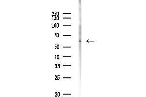 Western blot analysis of lysates from K562 cells(UV 30 min treatment), using VGlu Antibody at 1/1000 dilution.