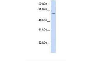 Image no. 1 for anti-Porcupine Homolog (PORCN) (AA 38-87) antibody (ABIN6738612) (PORCN antibody  (AA 38-87))