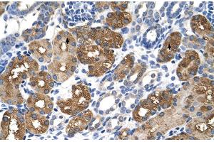 Immunohistochemistry (IHC) image for anti-Betaine--Homocysteine S-Methyltransferase (BHMT) (C-Term) antibody (ABIN2776836)