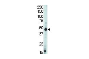 Western blot analysis of anti-PRKAR1B Pab (ABIN391061 and ABIN2841216) in mouse liver tissue lysate. (Protein Kinase A beta (AA 50-80), (N-Term), (Regulatory Subunit 1) antibody)