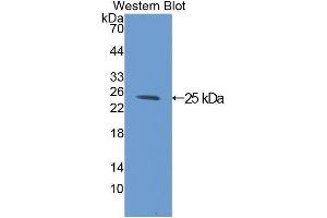 Western Blotting (WB) image for anti-Complement Component 1, Q Subcomponent Binding Protein (C1QBP) (AA 72-279) antibody (ABIN1078151)