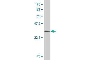 Western Blot detection against Immunogen (36. (PKNOX1 antibody  (AA 2-100))