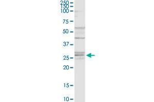 NAT6 MaxPab rabbit polyclonal antibody. (NAT6 antibody  (AA 1-308))