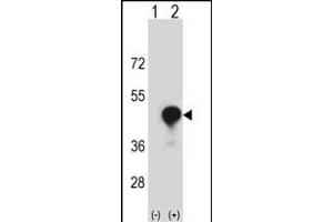 Western blot analysis of CD1C (arrow) using rabbit polyclonal CD1C Antibody (C-term) (ABIN657353 and ABIN2837919). (CD1c antibody  (C-Term))