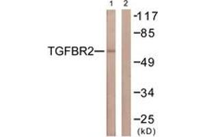 Western blot analysis of extracts from NIH-3T3 cells, using TGF beta Receptor II (Ab-250) Antibody.