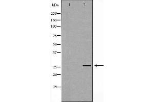 Western blot analysis of recombinant protein using Rabl2 antibody. (Rabl2 antibody)