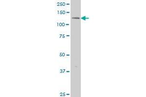 ERN1 monoclonal antibody (M06), clone 3D1 Western Blot analysis of ERN1 expression in HeLa . (ERN1 antibody  (AA 401-500))