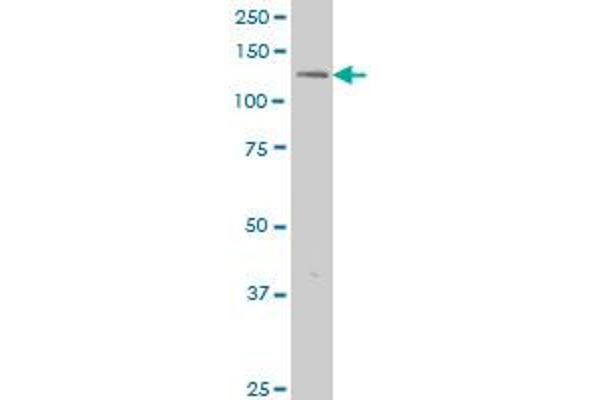 ERN1 antibody  (AA 401-500)