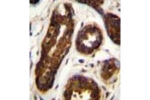 Immunohistochemistry (Paraffin-embedded Sections) (IHC (p)) image for anti-serpin Peptidase Inhibitor, Clade B (Ovalbumin), Member 5 (SERPINB5) (AA 101-131), (Middle Region) antibody (ABIN954746)