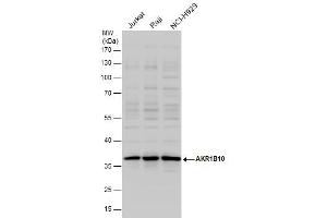 WB Image AKR1B10 antibody detects AKR1B10 protein by western blot analysis. (AKR1B10 antibody)