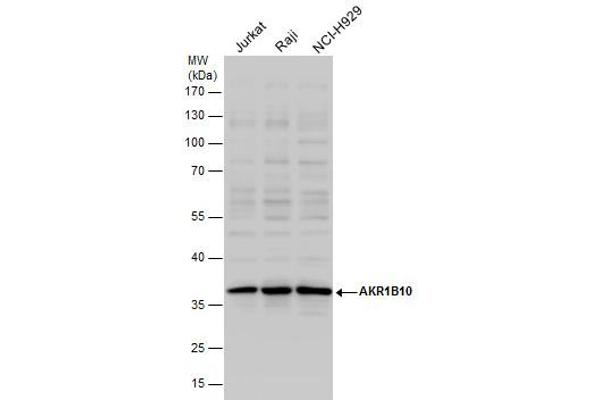 AKR1B10 Antikörper