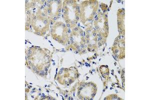 Immunohistochemistry of paraffin-embedded human gastric using MRPS22 antibody at dilution of 1:100 (x40 lens).
