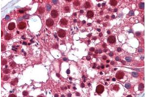 anti-Lysine (K)-Specific Demethylase 6A (KDM6A) (C-Term) antibody