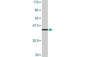 Western Blot detection against Immunogen (38. (Eppin antibody  (AA 22-133))