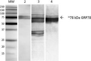 Western Blot analysis of Human, Mouse, Rat NIH3T3, Rat Brain, and HEK-293 cell lysates showing detection of ~78 kDa GRP78 protein using Mouse Anti-GRP78 Monoclonal Antibody, Clone 3C5-1A4 .