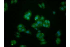 Immunofluorescence staining of HepG2 cells with ABIN7156735 at 1:133, counter-stained with DAPI. (IL1RAPL1 antibody  (AA 564-679))