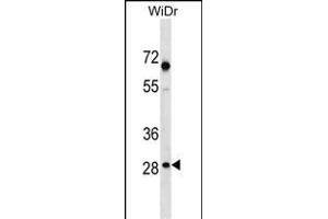 SNX11 Antibody (Center) (ABIN1538607 and ABIN2850241) western blot analysis in WiDr cell line lysates (35 μg/lane). (SNX11 antibody  (AA 75-104))