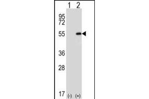 Western blot analysis of DDX39 (arrow) using rabbit polyclonal DDX39 Antibody (Center ) (ABIN652341 and ABIN2841566).