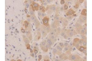 IHC-P analysis of Human Liver Tissue, with DAB staining. (NEU1 antibody  (AA 47-415))