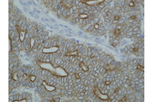 pan Keratin antibody