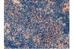 IHC-P analysis of Mouse Spleen Tissue, with DAB staining. (PARP1 antibody  (AA 661-881))