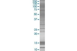 GJB5 transfected lysate. (GJB5 293T Cell Transient Overexpression Lysate(Denatured))