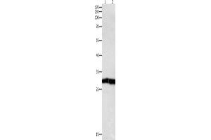 Western Blotting (WB) image for anti-Dual Specificity Phosphatase 6 (DUSP6) antibody (ABIN2421547) (DUSP6 antibody)