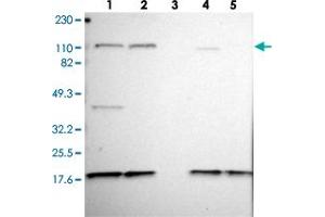 Western blot analysis of Lane 1: RT-4, Lane 2: U-251 MG, Lane 3: Human Plasma, Lane 4: Liver, Lane 5: Tonsil with KIF5A polyclonal antibody .