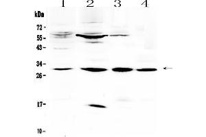 Western blot analysis of VEGFB using anti-VEGFB antibody .