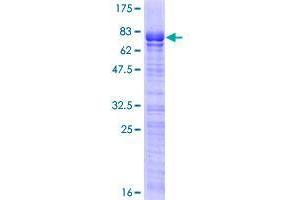 SOX7 Protein (AA 1-388) (GST tag)