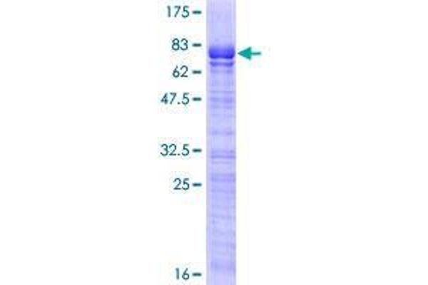 SOX7 Protein (AA 1-388) (GST tag)